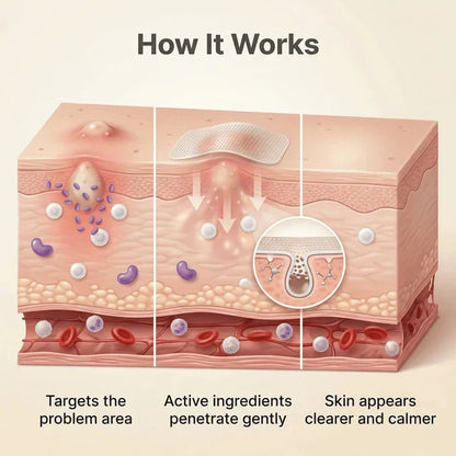 DermaSmooth - Tag & Mole Remover (BUY 1 GET 1 FREE)